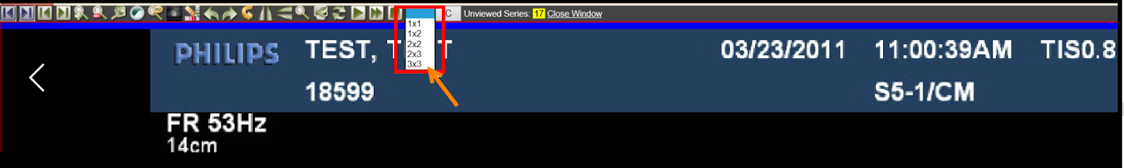 623c85a72bc115ff6a2c357be897775a